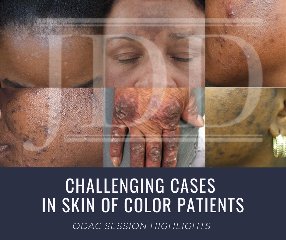 Skin of Color patient dermatology cases