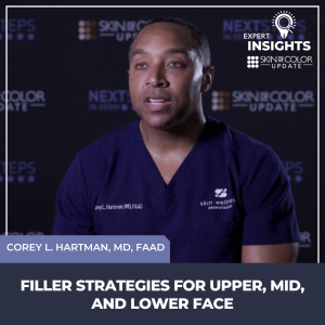 Aesthetic fillers at Skin of Color Update Corey Hartman