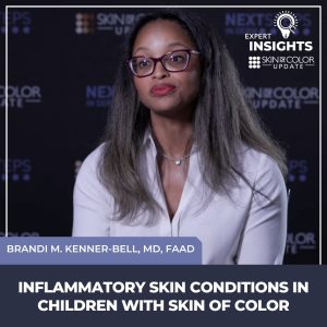 inflammatory skin conditions in children with skin of color