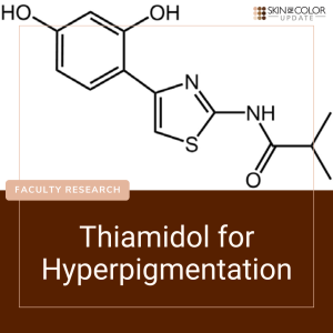 hyperpigmentation