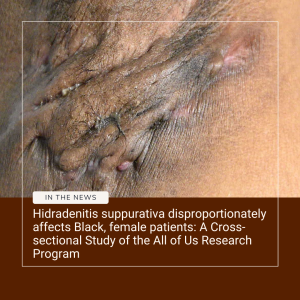 hidradenitis suppurativa