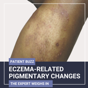 eczema-related pigmentary changes