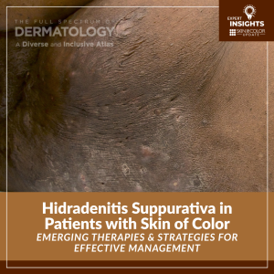 hidradenitis suppurativa