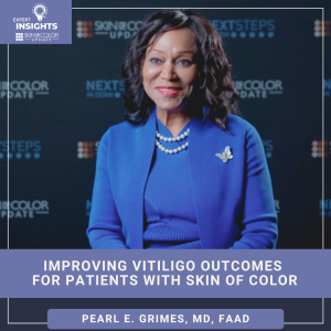 vitiligo in patients with skin of color