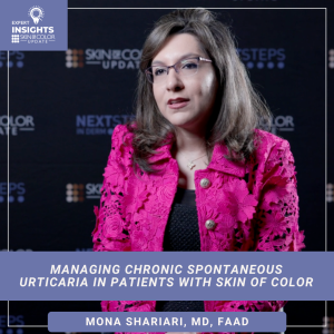 chronic spontaneous urticaria in skin of color