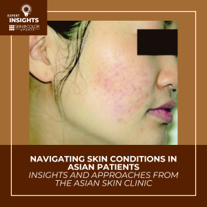 Asian skin dermatology