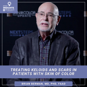 keloids
