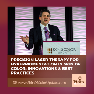 precision laser therapy for hyperpigmentation
